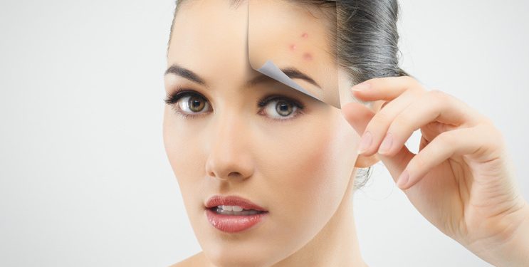 Những nguy hại đằng sau lớp da nhờn